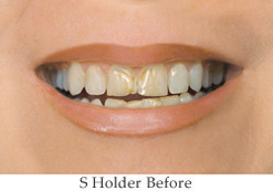 Dentist in Burlington