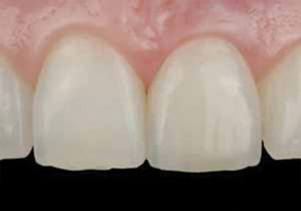 Dentist in Burlington