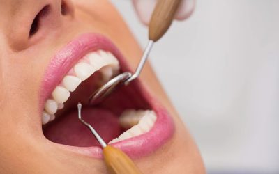 How Our Burlington Dentist Provides Painless, Relaxing Dental Care at Appleby Dental