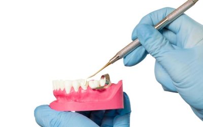 How Restorative Dentist Can Improve Your Oral Health