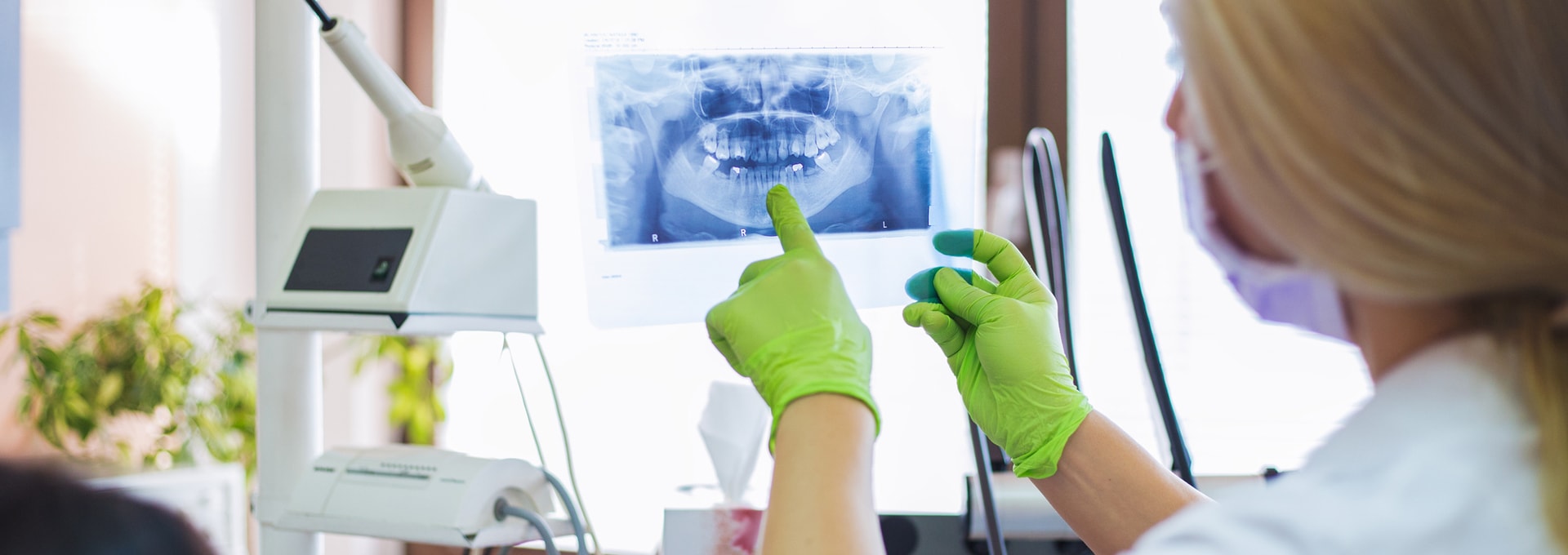 wisdom teeth extraction Wisdom Teeth Extractions in Markham and North York