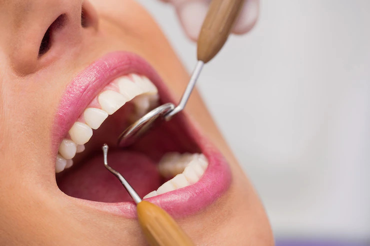 How Our Burlington Dentist Provides Painless, Relaxing Dental Care at Appleby Dental