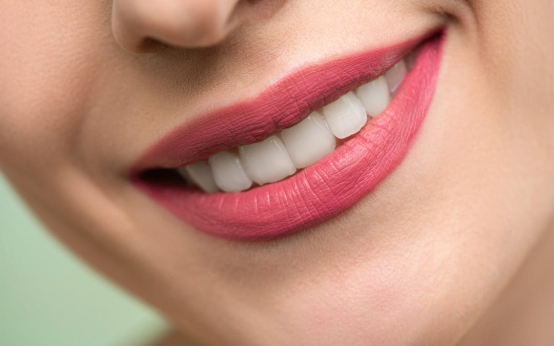 Illuminating Smiles: The Bright Side of Professional Teeth Whitening