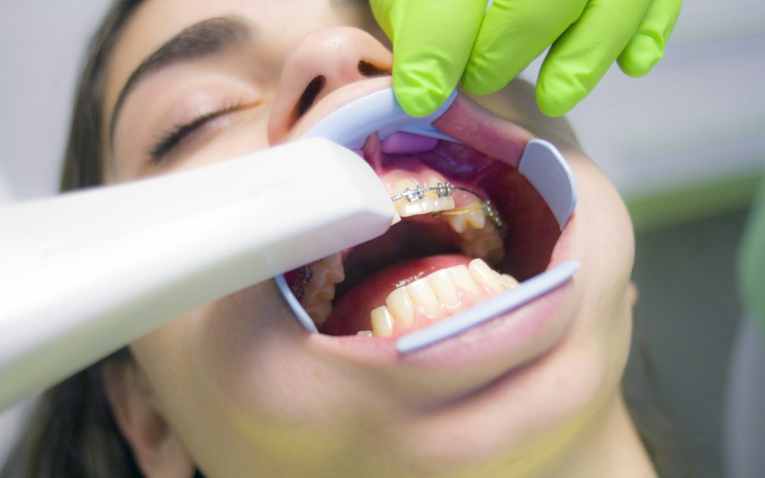 Embrace the Future of Orthodontics: Modern Solutions Beyond Braces