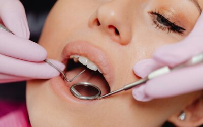 What Counts as a Dental Emergency?